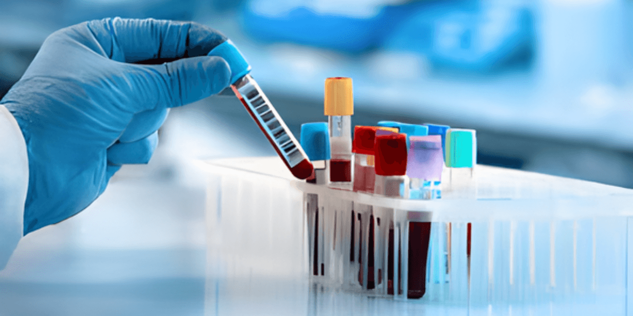 Lab investigations