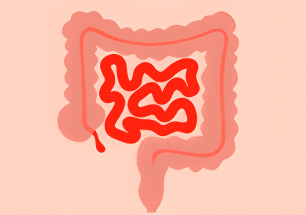 ibs